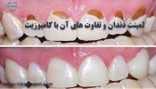 laminate dental.jpg